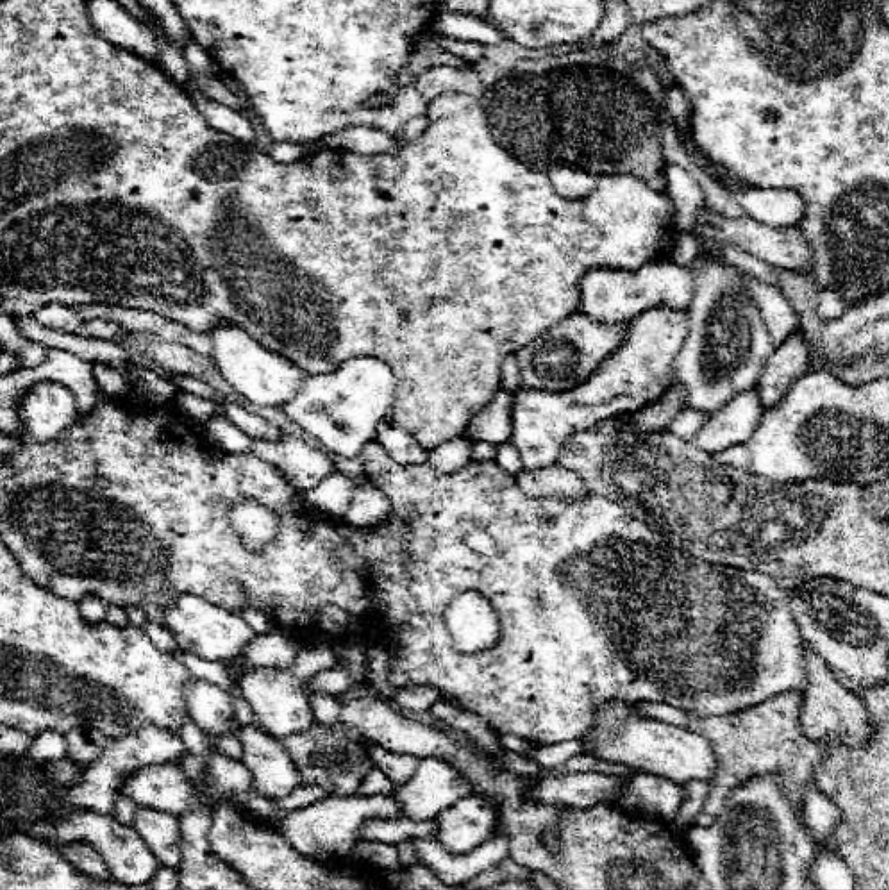 A square black-and-white electron micrograph filled edge to edge with tissue at extreme magnification. Irregular pale membranes weave through the frame, outlining tightly packed cellular processes that look like tangled ribbons and tubes. Several large, dark, finely speckled oval mitochondria sit among them, with small dark rings and vesicles scattered through the pale interiors.